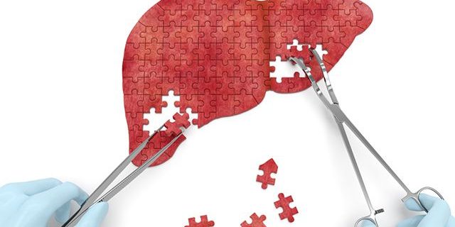 8 рецептов, которые помогут восстановить клетки печени