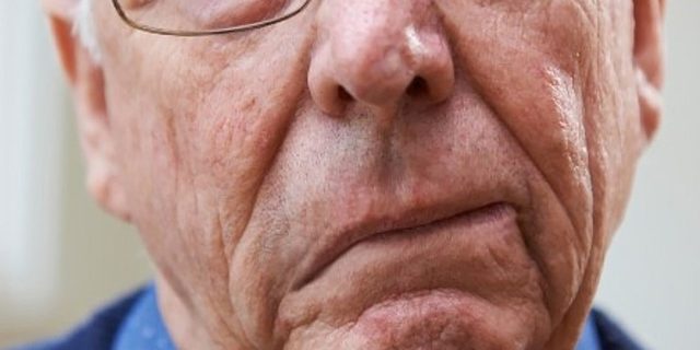 Инсульт на фоне COVID-19 развивается реже, чем считалось — исследование