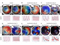 Возраст стволовых клеток играет важную роль, с точки зрения регенерации тканей