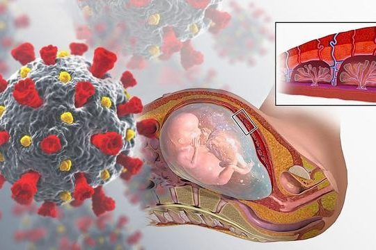 Исследование показало, как коронавирус влияет на плаценту