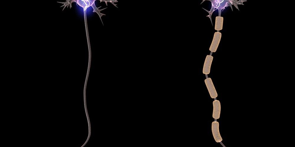 У синдрома Туретта может появиться эффективное лечение