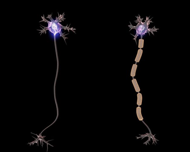 У синдрома Туретта может появиться эффективное лечение