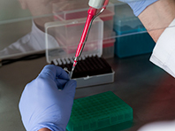 Новый тест крови позволит понять, какова физическая кондиция человека