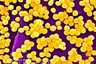 Устойчивый к терапии золотистый стафилококк победили природным лекарством