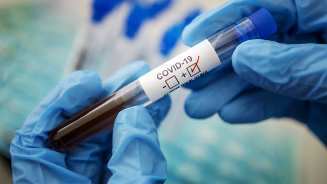 COVID-19 может оказаться сосудистой, а не респираторной болезнью