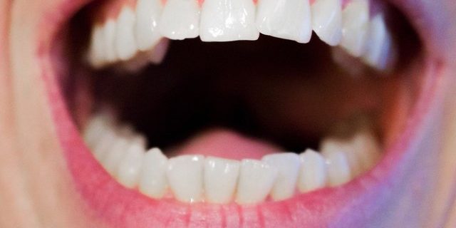 Выучить назубок: 5 продуктов для укрепления зубов и десен