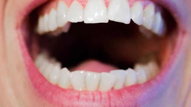 Выучить назубок: 5 продуктов для укрепления зубов и десен