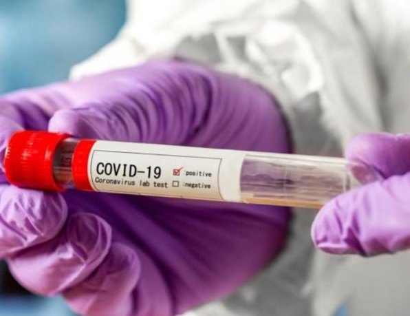 Вирусологи объяснили, почему ошибаются тесты на COVID-19