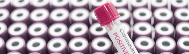 Москва лидирует среди мегаполисов по объему тестирования на коронавирус