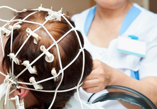 Старческое слабоумие попробуют лечить электричеством