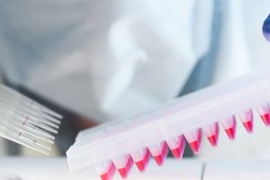 Начал работу европейский проект по ускорению разработки препаратов для лечения COVID-19