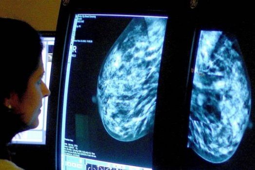 Обследование груди среди женщин в возрасте 40-49 лет спасает до 400 жизней ежегодно — исследование