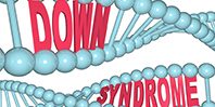 Открытие: носители синдрома Дауна имеют встроенную защиту от раковых опухолей