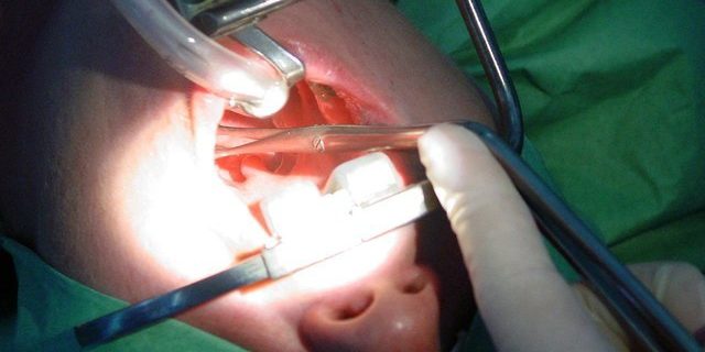 Семь раз отмерь: ликбез по гландам