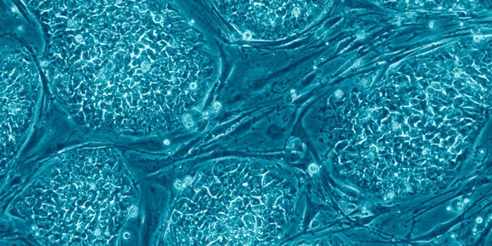 Стволовые клетки могут помочь в лечении болезни Паркинсона