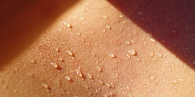 Льет как из ведра: где заканчивается норма потоотделения