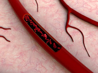 Российские инженеры разработали уникальные протезы мелких сосудов