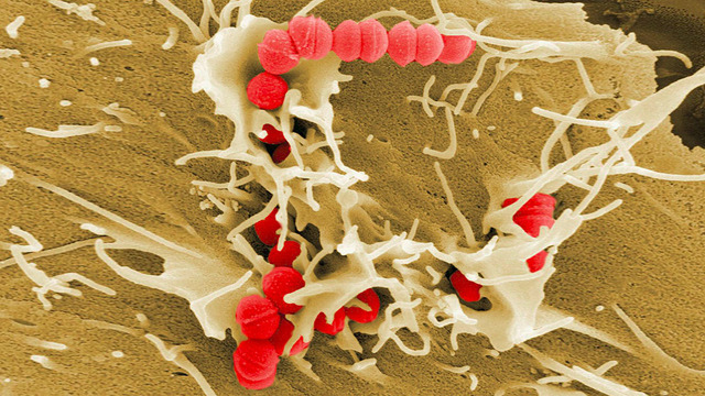 Ученые рассказали, почему скарлатина возвращается