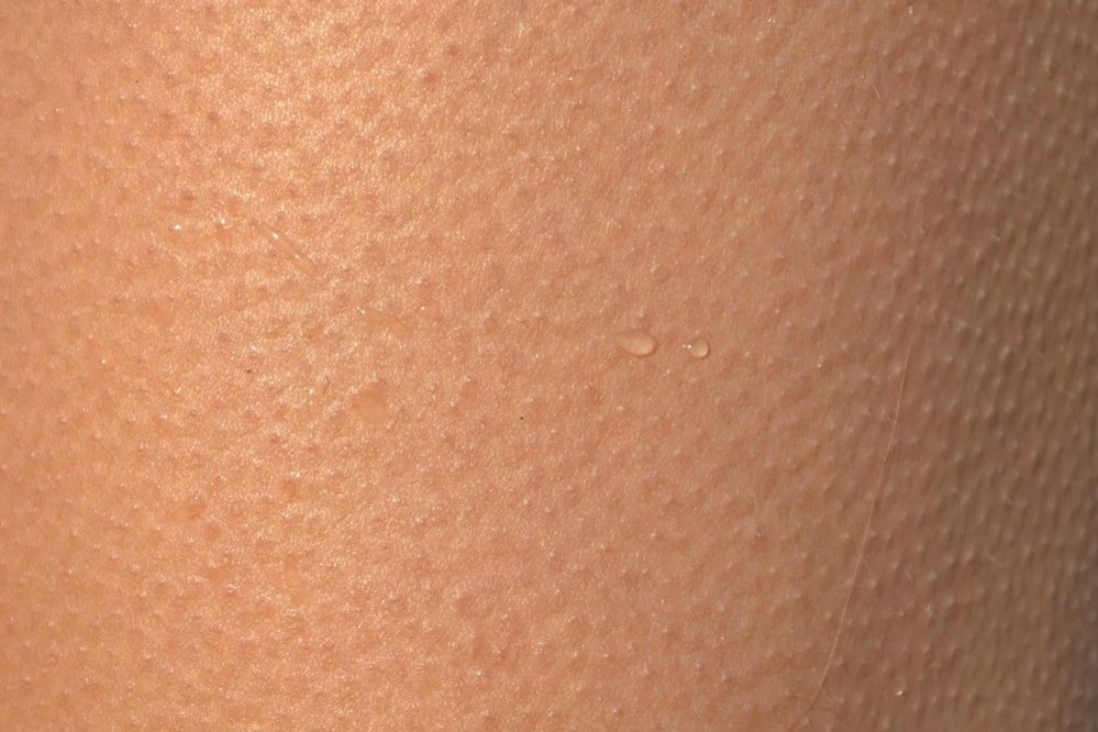 Обнаружить болезнь Паркинсона можно по кусочку кожи