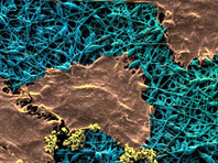 Продвинутый перевязочный материал перевернет медицину