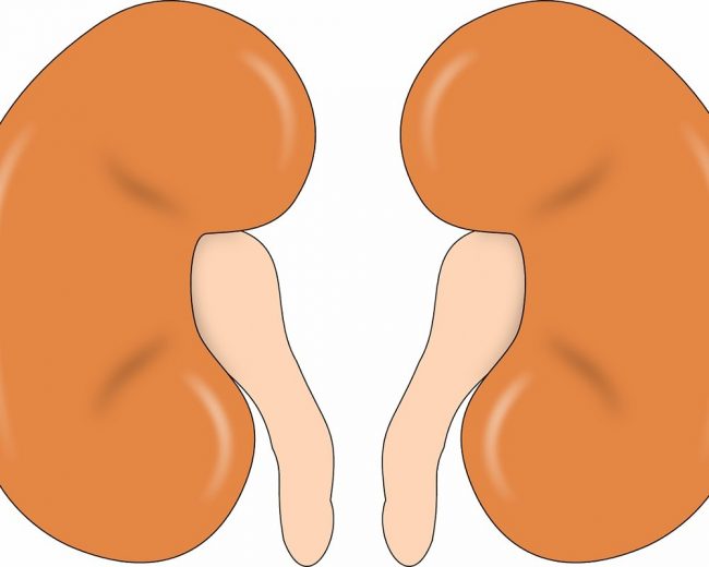 Ученые научились прогнозировать острую почечную недостаточность у детей