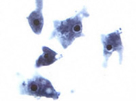 Глобальное потепление грозит новыми случаями опасной инфекции