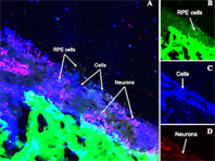 Новый имплантат может решить проблему потери зрения раз и навсегда