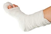 Эксперты пролили свет на возникновение переломов у некоторых людей