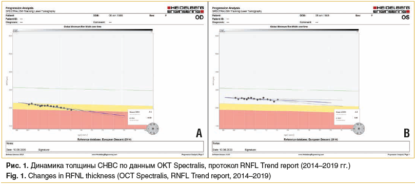 Рис. 1. Динамика толщины СНВС по данным ОКТ Spectralis, протокол RNFL Trend report (2014–2019 гг.) Fig. 1. Changes in RFNL thickness (OCT Spectralis, RNFL Trend report, 2014–2019)
