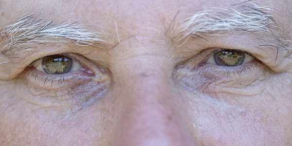 Ученые научились определять болезнь Альцгеймера по глазам