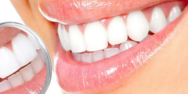 Названы продукты, после которых может понадобиться отбеливание зубов