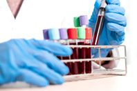 После COVID-19 следует сдать ряд анализов, советует эксперт