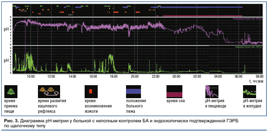 Рис. 3. Диаграмма рН-метрии у больной с неполным контролем БА и эндоскопически подтвержденной ГЭРБ по щелочному типу