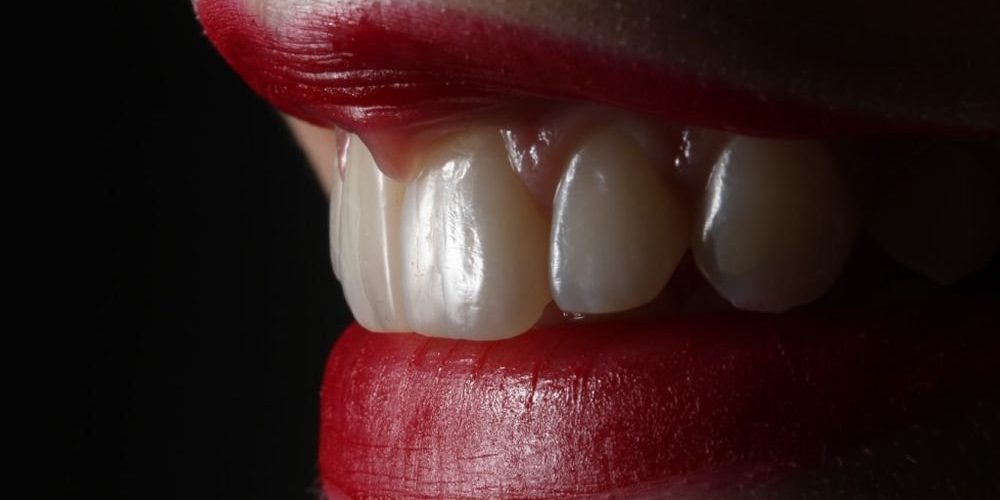 Болезни дёсен связали со старческим слабоумием