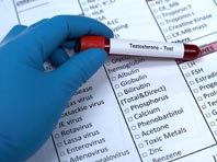 Медики узнали, почему высокий уровень тестостерона опасен для мужчин и женщин