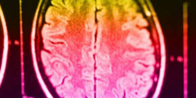 Невролог рассказал о взаимосвязи мозговых травм со склонностью к преступлениям