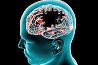 Простая проверка покажет, кто пострадает от болезней головного мозга