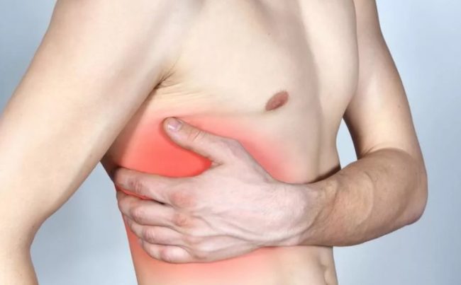 Почему болит в груди: как распознать межреберную невралгию