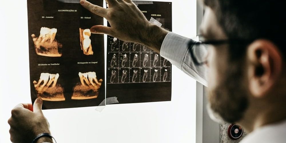 Потеря зубов грозит старческим слабоумием