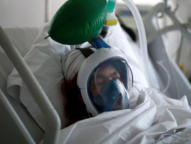 Более тяжелое течение COVID-19 у мужчин объяснили особенностями метаболизма