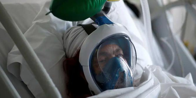 Более тяжелое течение COVID-19 у мужчин объяснили особенностями метаболизма