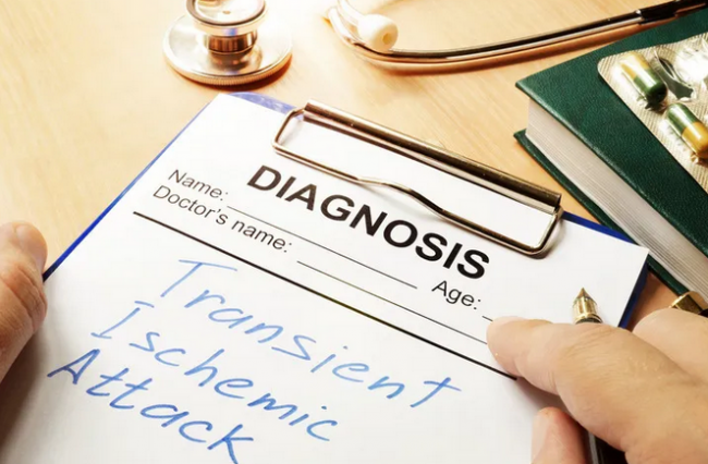 Ученые назвали привычку, повышающую риск инсульта