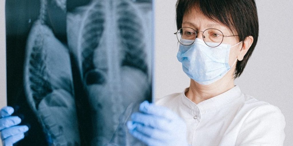 Почему у некурящих людей может развиться рак легкого? Новые данные