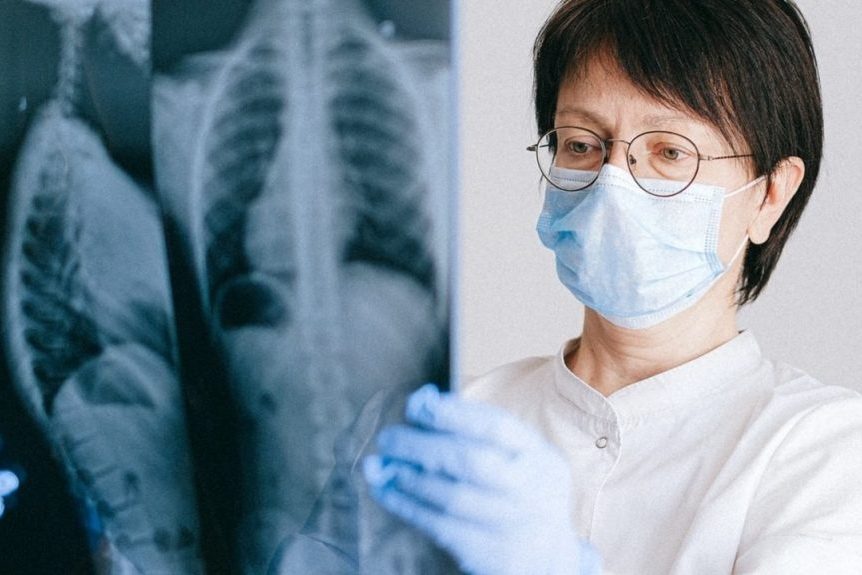 Почему у некурящих людей может развиться рак легкого? Новые данные