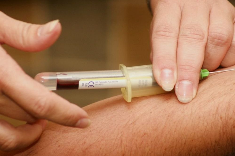 Новый анализ крови улучшит диагностику повреждений мозга