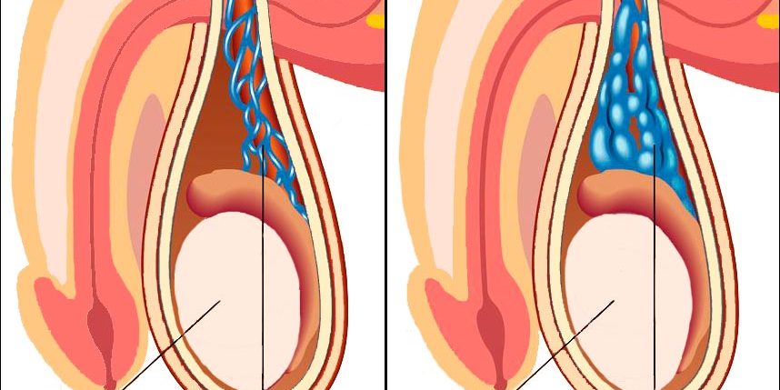 db5e696970c0505234cdde698710ef69