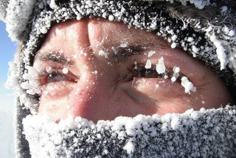 Откуда берётся аллергия на холод и как с ней бороться