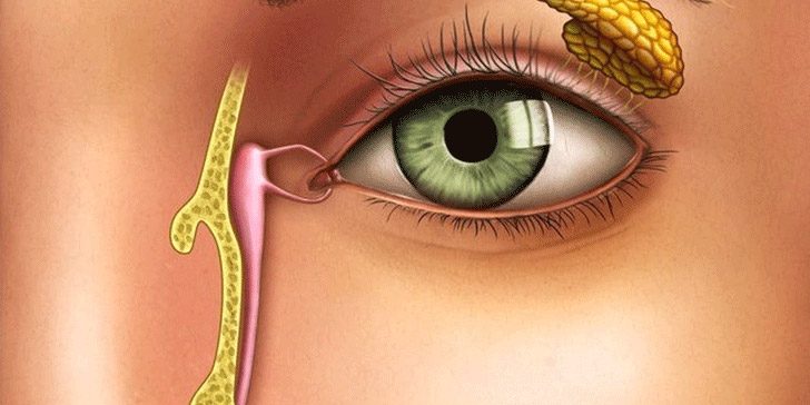 slezotochenie-is-glaz дакриоцистит