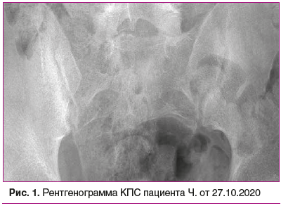 Рис. 1. Рентгенограмма КПС пациента Ч. от 27.10.2020