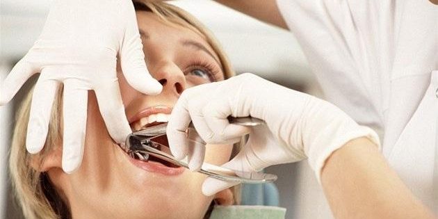 Стоматолог назвала 3 причины удалить зубы мудрости как можно быстрее